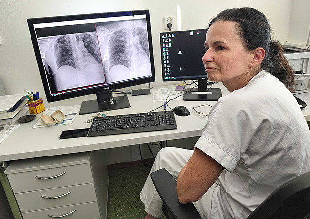 Oko Carebota odhalí i rakovinu plic. AI ve Šternberku pomáhá zachraňovat životy