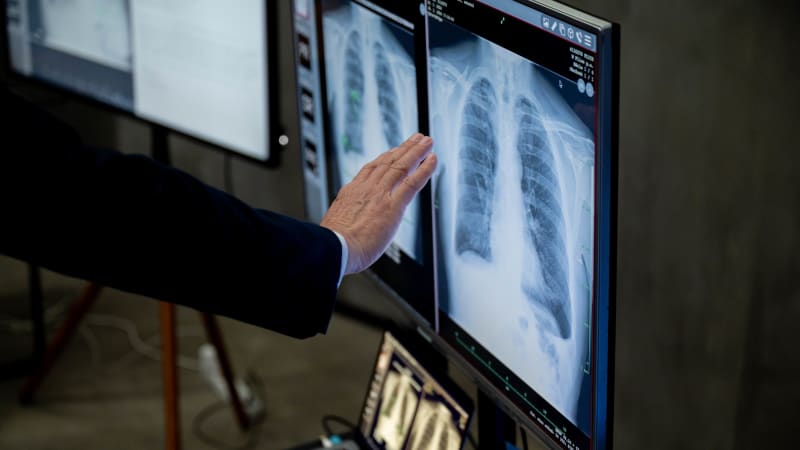 K lékaři šla Češka se zlomeným žebrem. Nečekaný nález umělé inteligence jí zachránil život